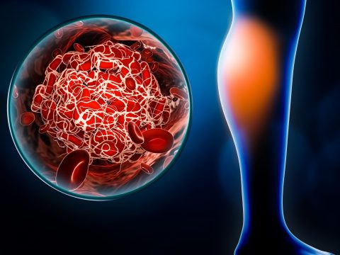 causes-of-vascular-diseases