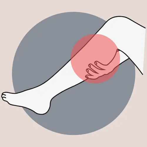 Signs-of-varicose-veins-2