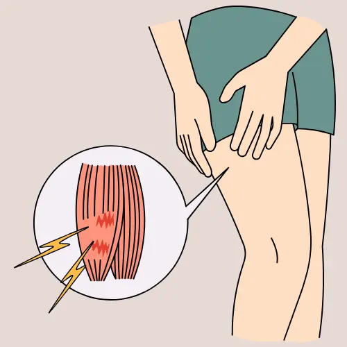 Signs-of-varicose-veins-3