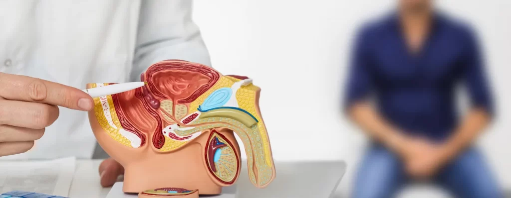 can-varicocele-affect-testosterone