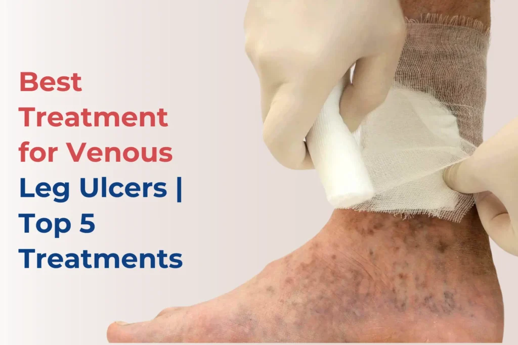 best-treatment-for-venous-leg-ulcers