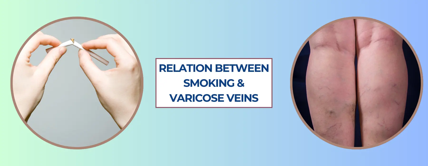 how-smoking-affects-varicose-veins