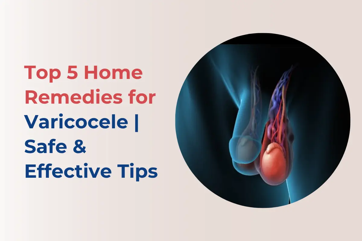 top-5-home-remedies-for-varicocele