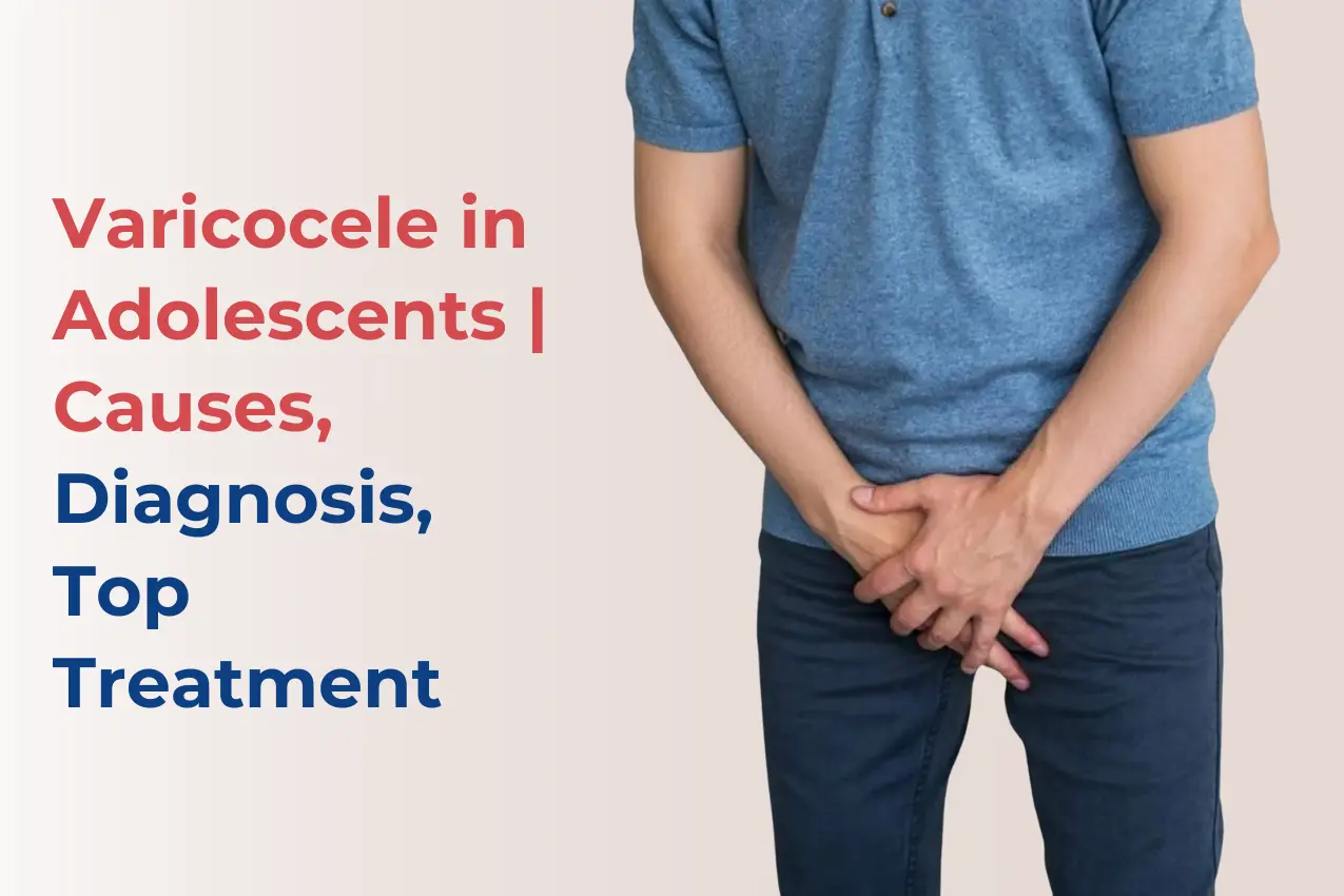 varicocele-in-adolescents-treatment