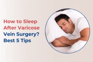 how-to-sleep-after-varicose-vein-surgery-tips