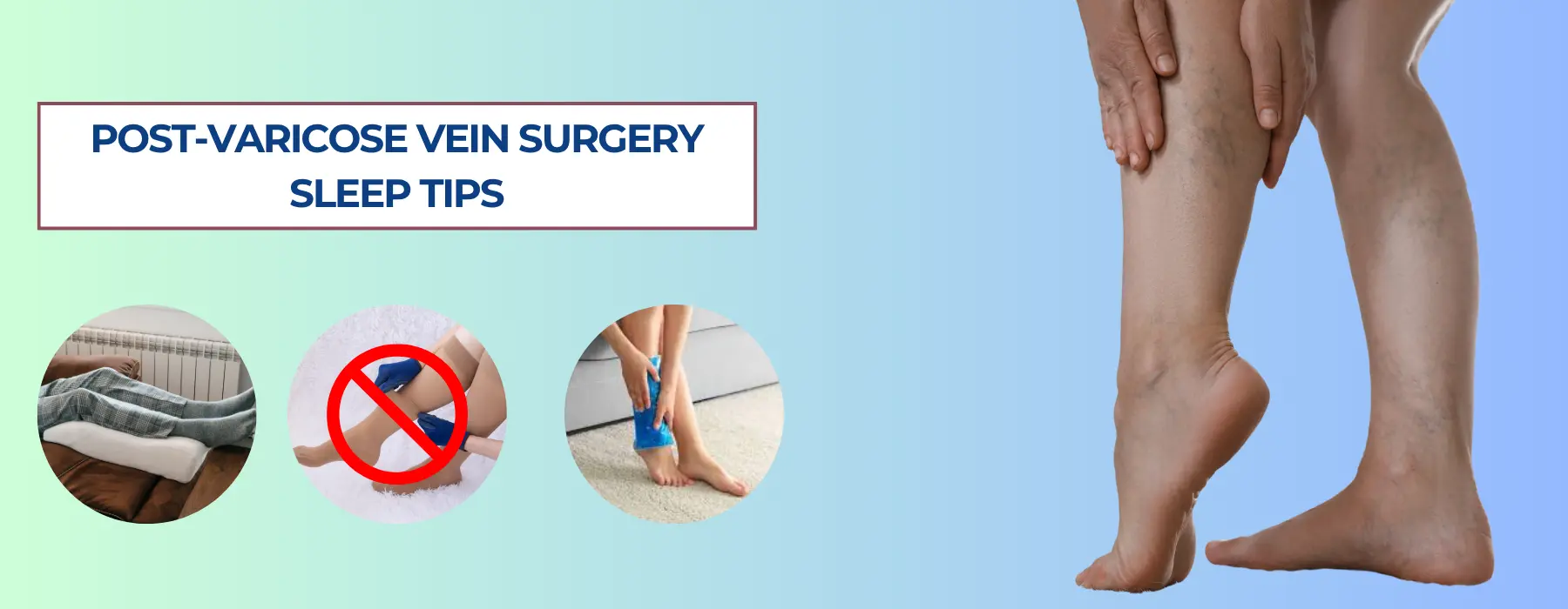 how-to-sleep-after-varicose-vein-surgery