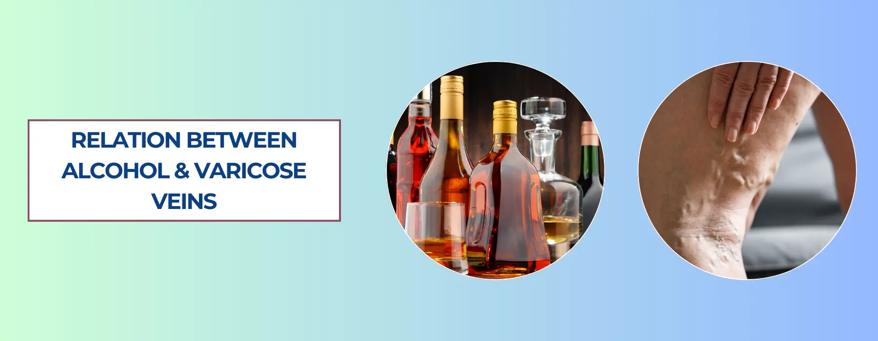 Does Alcohol Affect Varicose Veins