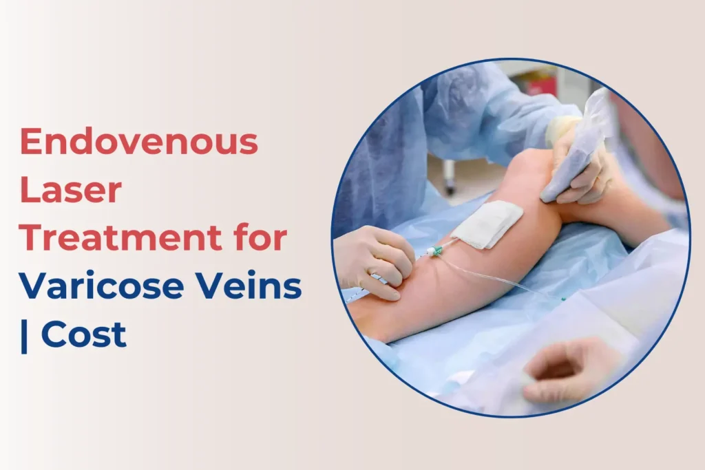 EVLT Treatment in Pune