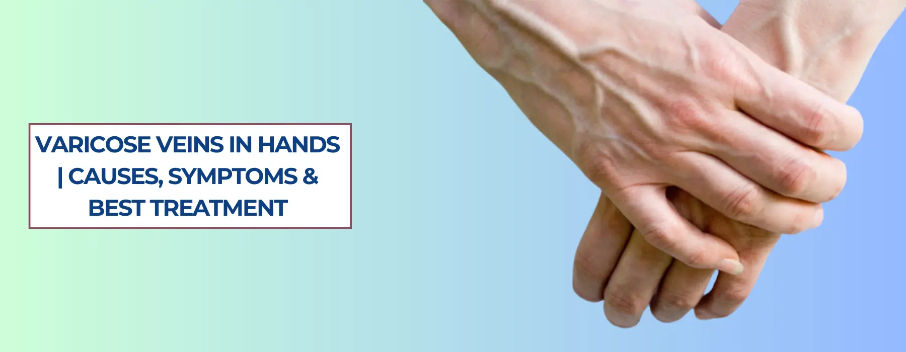 Varicose Veins in Hands