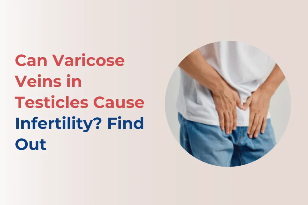 varicose veins in testicles & Infertility connection