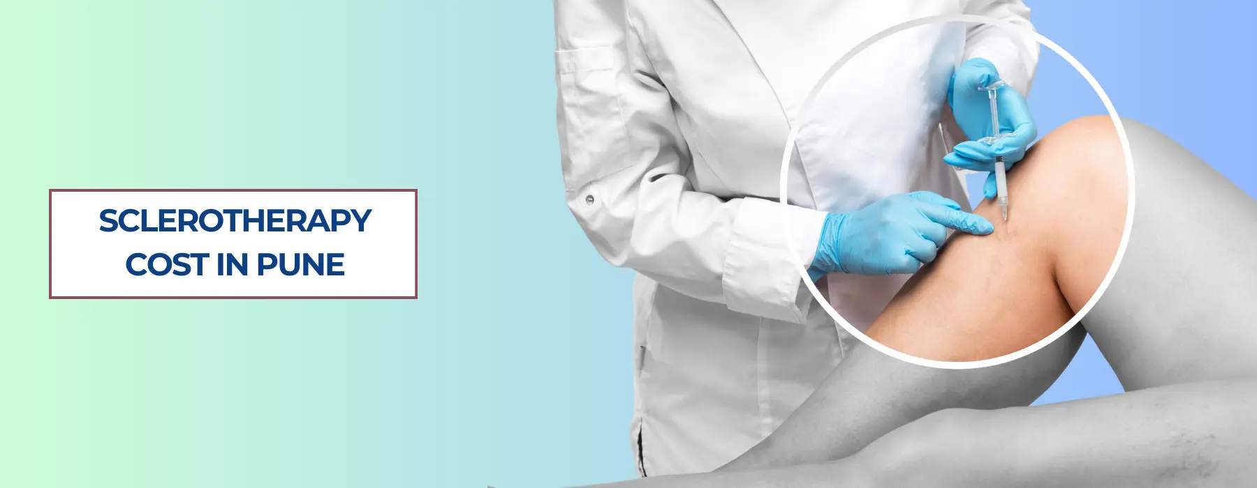 Sclerotherapy Cost in Pune