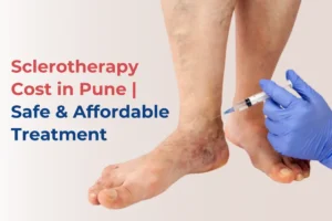 Sclerotherapy treatment Cost in Pune