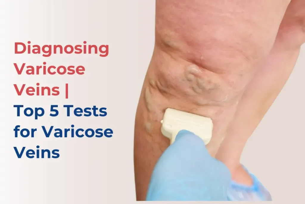 Top 5 Tests for Varicose Veins