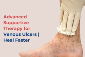 Advanced Supportive Therapy for Venous Ulcers