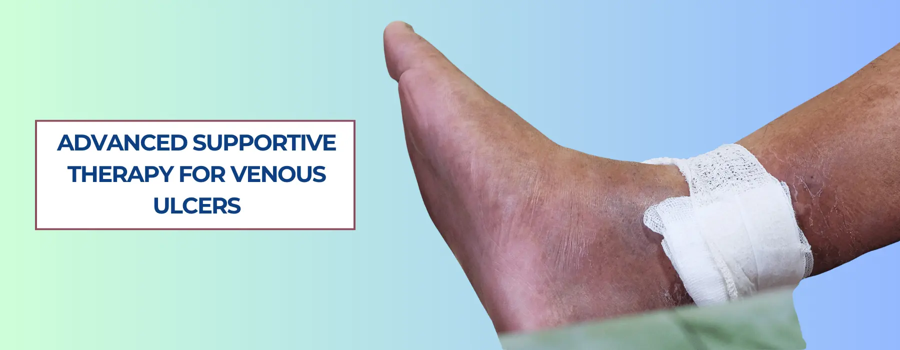 Supportive Therapy for Venous Ulcers