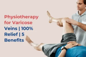 best Physiotherapy for Varicose Veins
