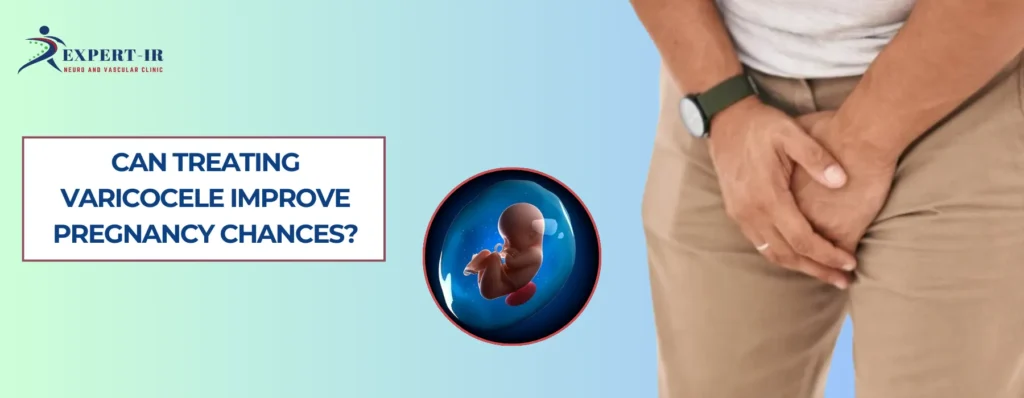 Can Treating Varicocele Improve Pregnancy Chances