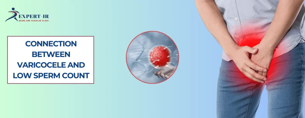 Can Varicocele Cause Low Sperm Count
