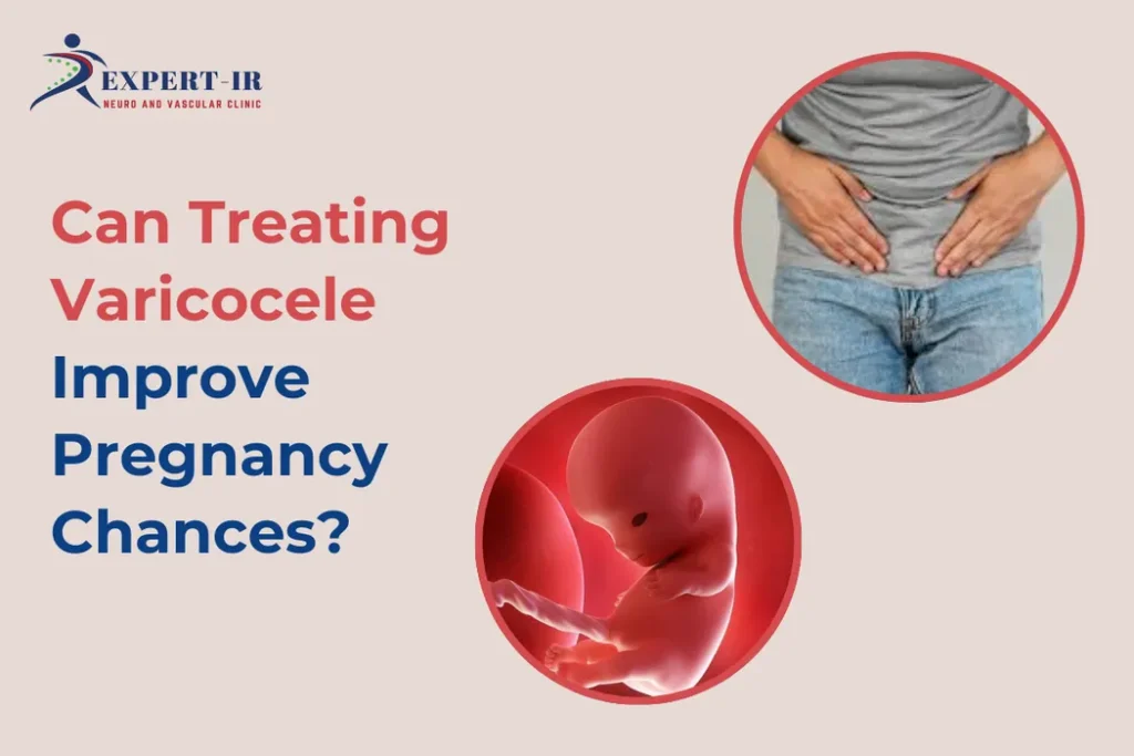 Varicocele-and-Pregnancy Chances