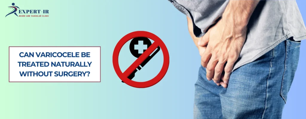 Can Varicocele Be Treated Naturally Without Surgery
