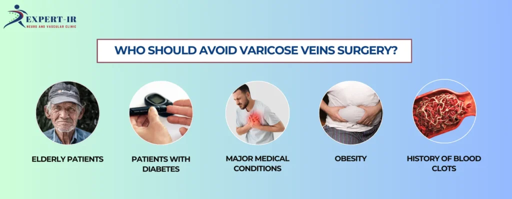 Who Should Avoid Varicose Veins Surgery