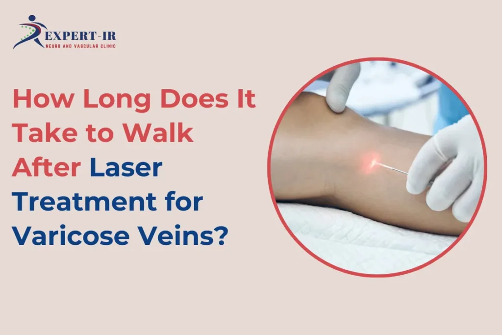 how to walk after Laser Treatment for Varicose Veins