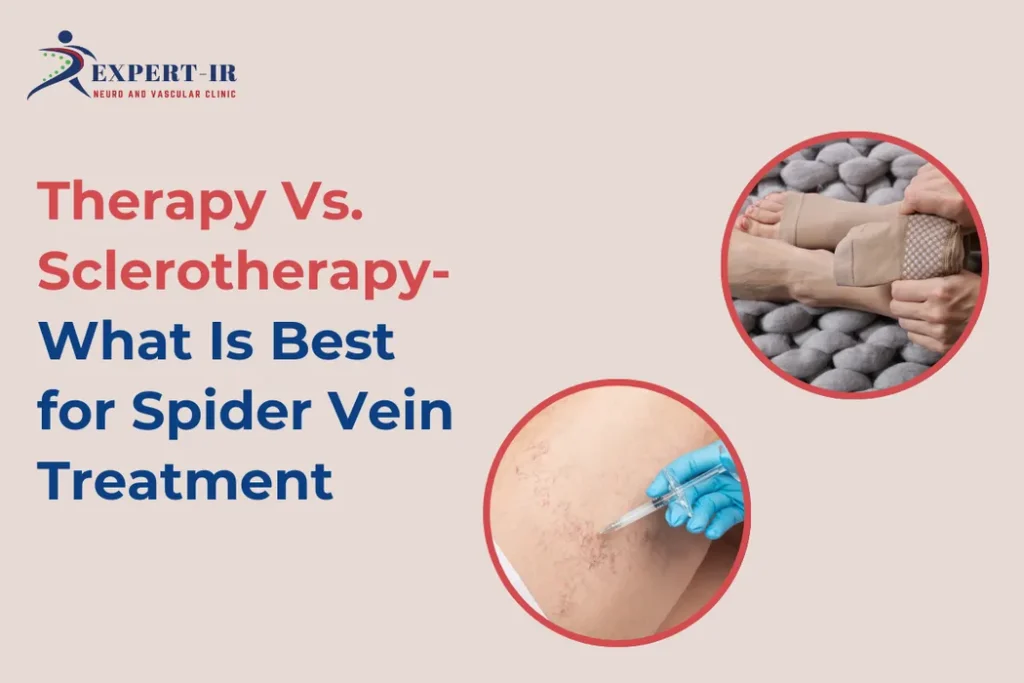 spider vein treatment in pune