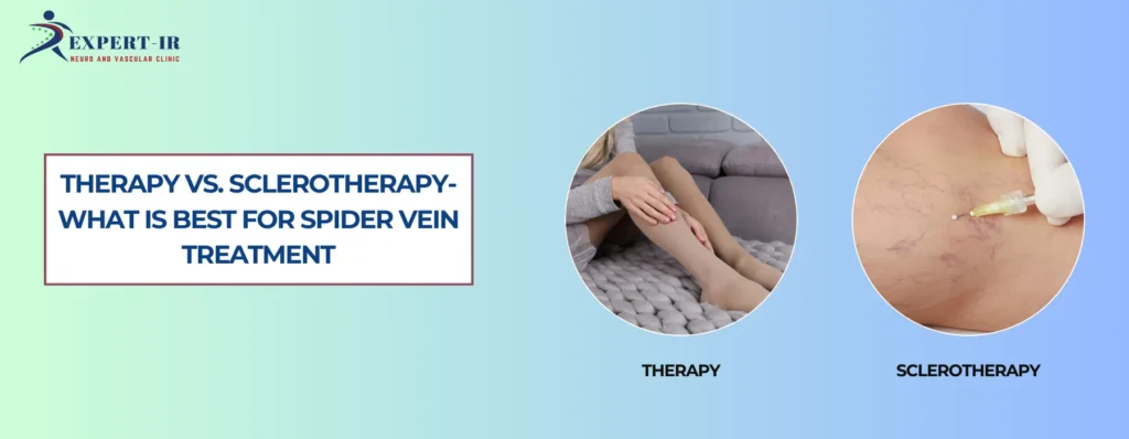 Therapy Vs. Sclerotherapy