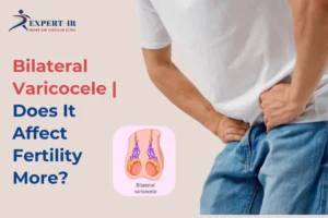 Bilateral Varicocele Does It Affect Fertility More