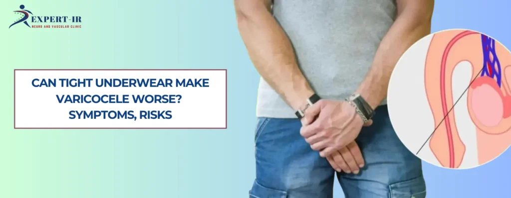 Can Tight Underwear Make Varicocele Worse