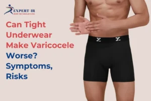 Does Tight Underwear causes varicocele