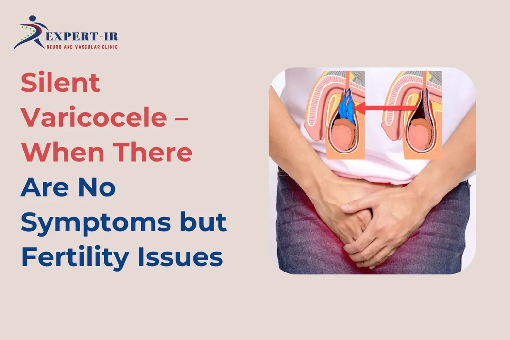 Silent Varicocele symptoms