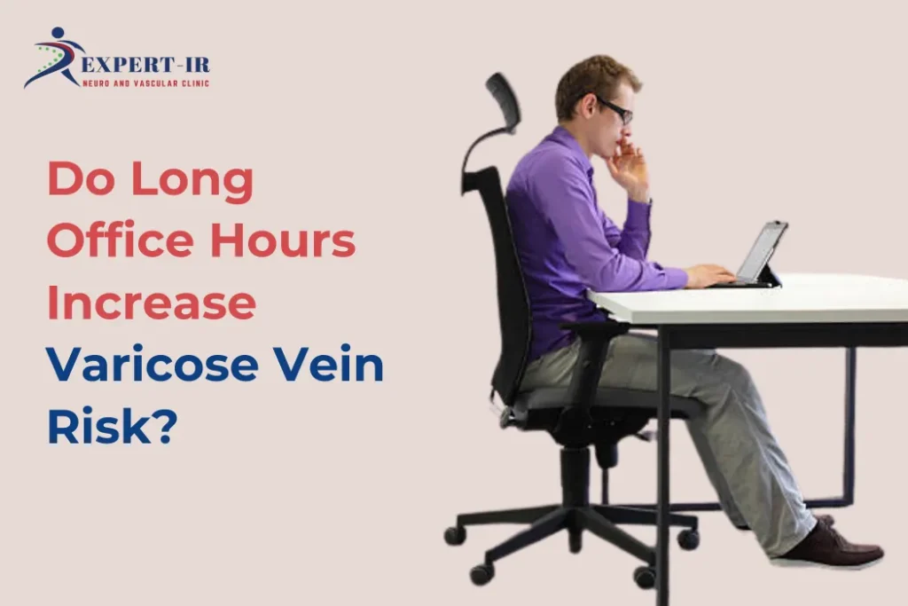 Varicose Vein Risk