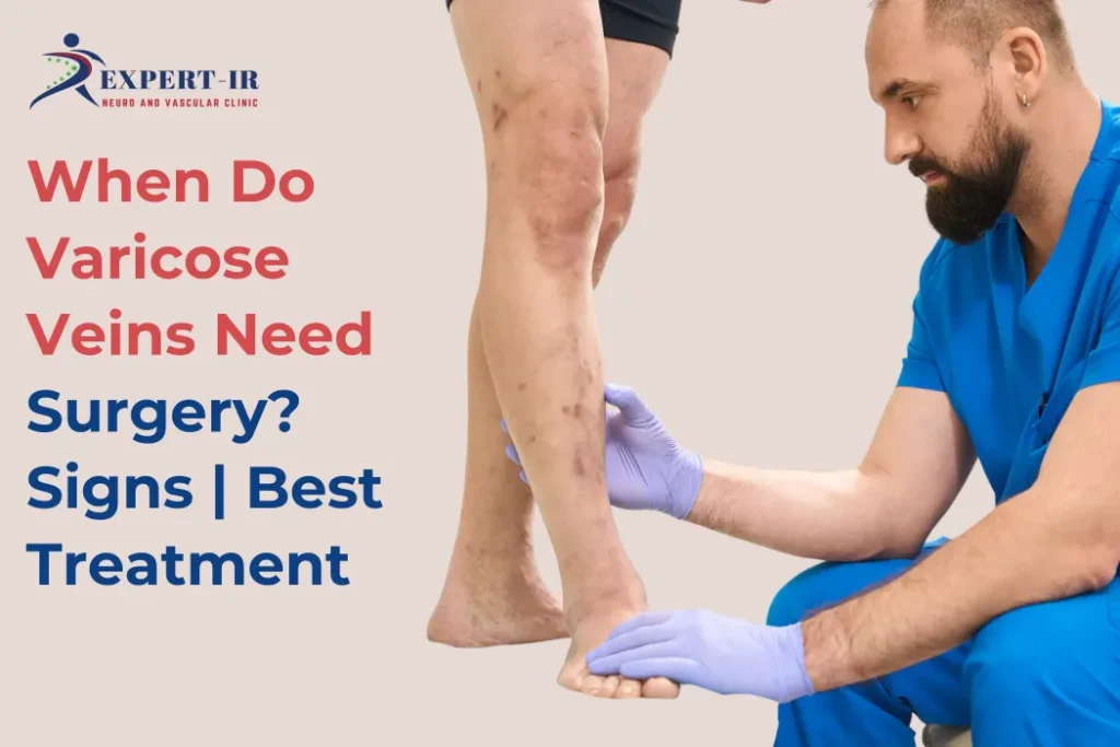 what are the signs of surgery in varicose veins surgery