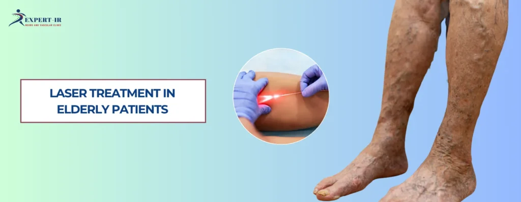 Is Laser Treatment Safe for Elderly Patients