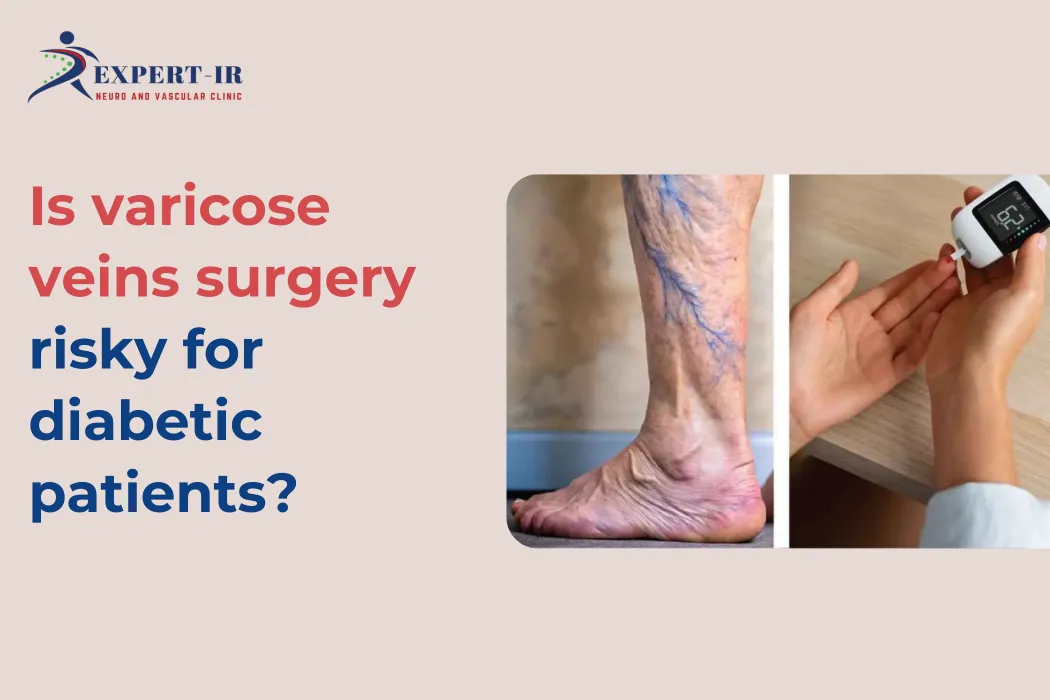 Is varicose veins surgery risky for diabetic patients