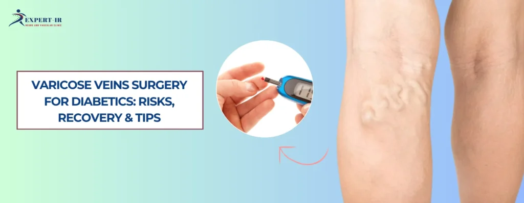 Varicose Veins Surgery for Diabetic patients Risks, Recovery & Tips