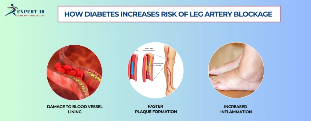 how diabetes increases risk of leg artery blockage
