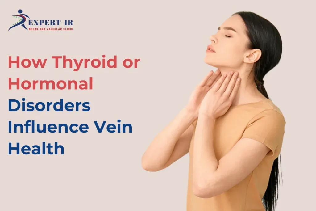 connection between Hormonal Disorders and Vein Health