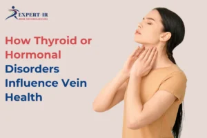 connection between Hormonal Disorders and Vein Health