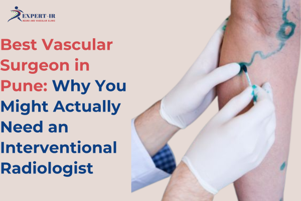 Best Vascular Surgeon in Pune: Why You Might Actually Need an Interventional Radiologist