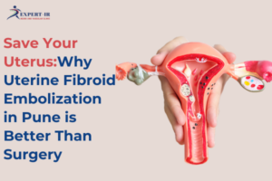 Save Your Uterus: Why Uterine Fibroid Embolization in Pune is Better Than Surgery