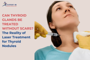 laser treatment for thyroid nodules Expert IR Dr Santosh Patil