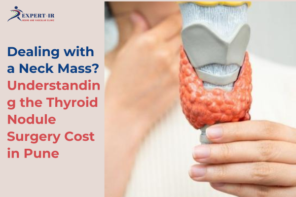 thyroid nodule surgery cost in Pune Expert IR Dr Santosh Patil