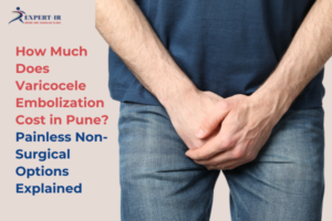 How Much Does Varicocele Embolization Cost in Pune? Painless Non-Surgical Options Explained