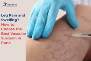 best vascular surgeon in Pune leg pain varicose veins treatment Expert IR