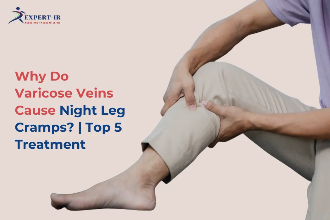 Top 5 treatment for Night cramps due to varicose veins