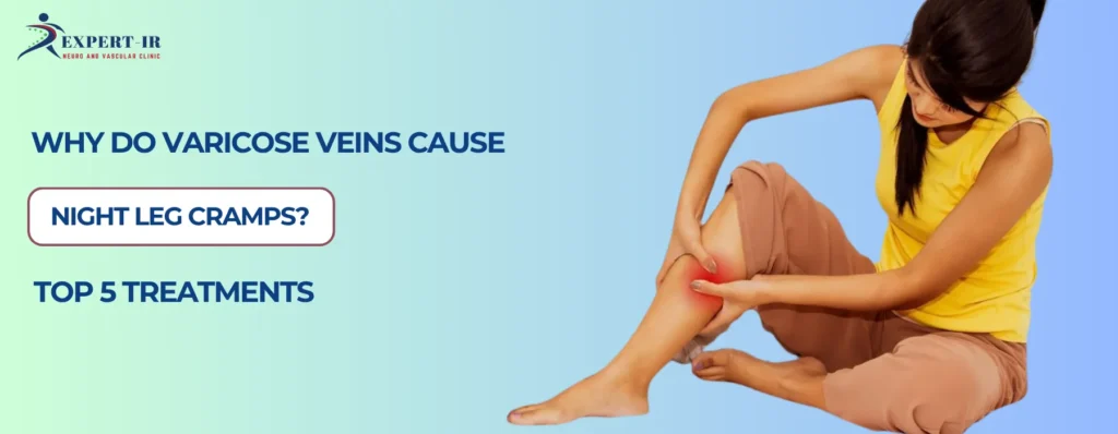 Why Do Varicose Veins Cause Night Leg Cramps
