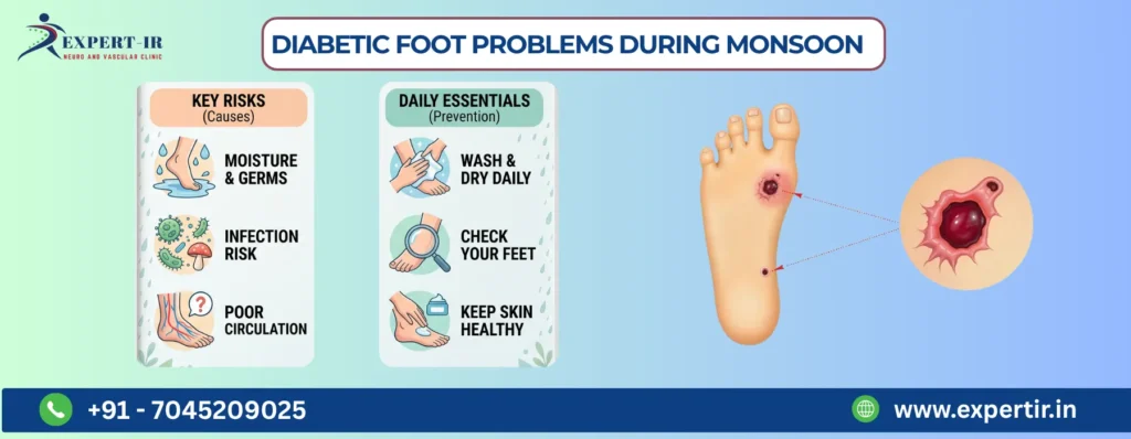 Diabetic Foot Problems During Monsoon