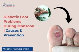 Prevention of Diabetic Foot During Monsoon